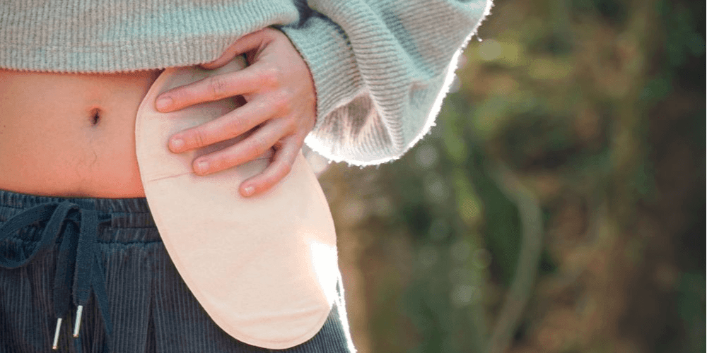 Ernährung bei Stoma Ernährung bei Stoma